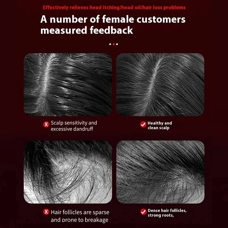 مشط تدليك كهربائي بالاهتزاز لل - مراجعة Hair Care For Hair Growth وسعره