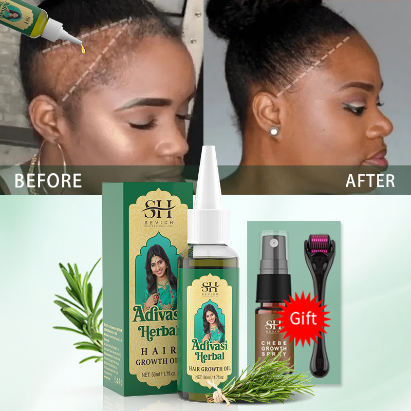 زيت نمو الشعر الأيورفيدي الهند - مراجعة Hair Care Essence Oil Spray وسعره