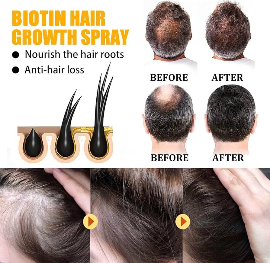 زيت باتانا، سيروم شعر كثيف، بخ - مراجعة Hair Care Essence Oil Spray وسعره