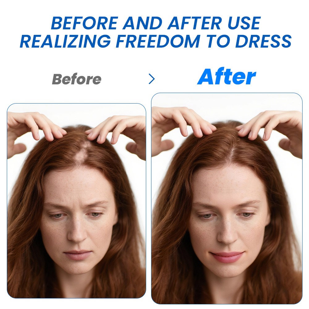 الثعلبة نمو الشعر رذاذ Sophora - مراجعة Hair Care For Hair Growth وسعره