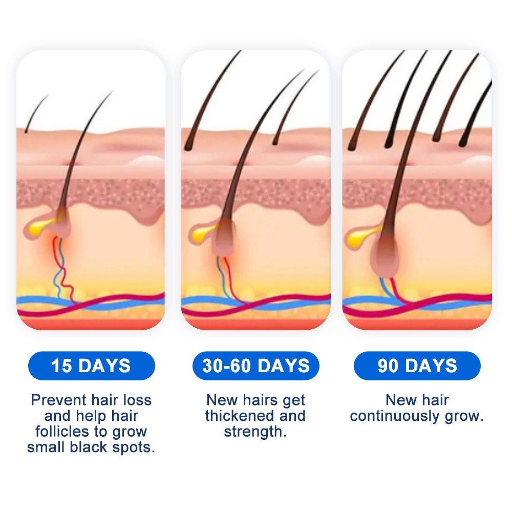 الثعلبة نمو الشعر رذاذ Sophora - مراجعة Hair Care For Hair Growth وسعره