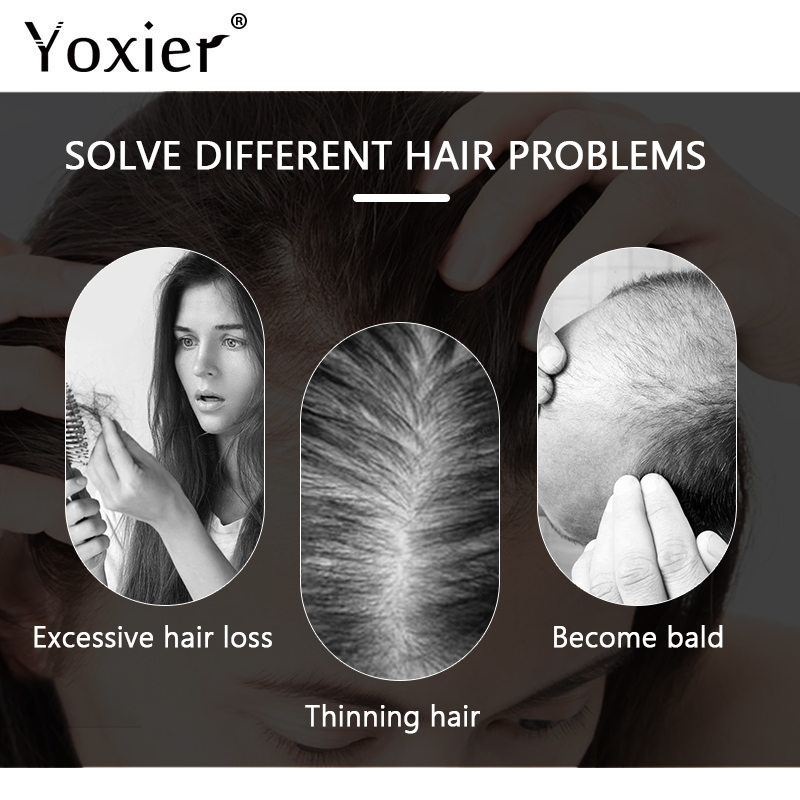 سيروم نمو مكثف يمنع تساقط الشع - مراجعة Hair Care For Hair Growth وسعره