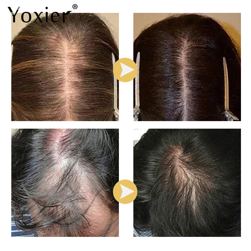 سيروم نمو مكثف يمنع تساقط الشع - مراجعة Hair Care For Hair Growth وسعره