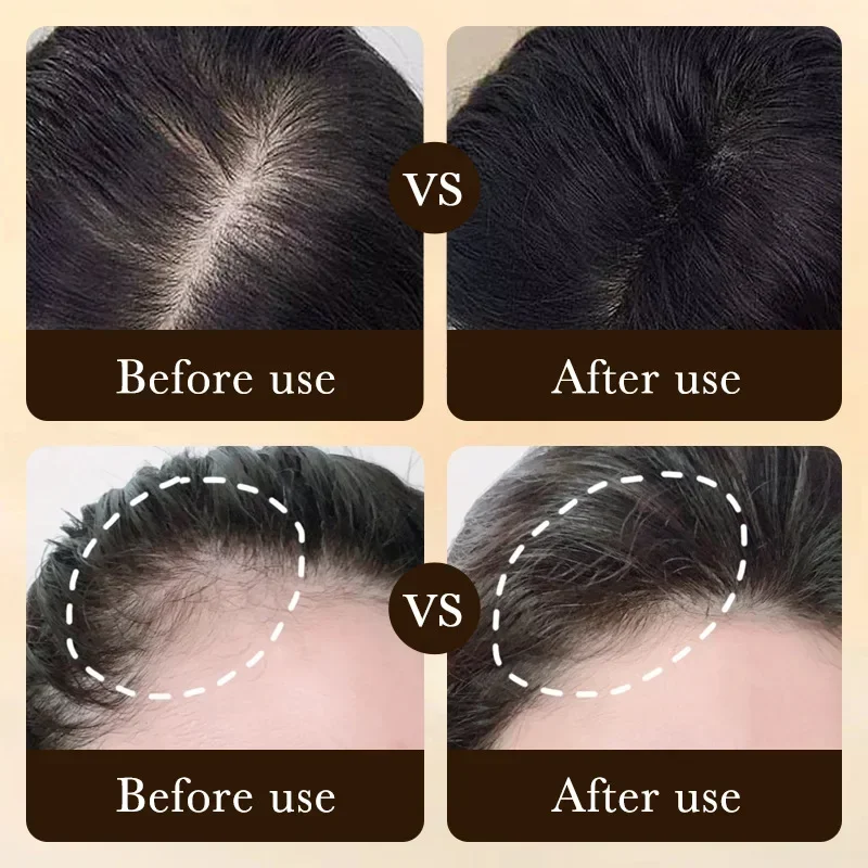 زيت البيوتين لنمو الشعر السريع - مراجعة Hair Care Essence Oil Spray وسعره