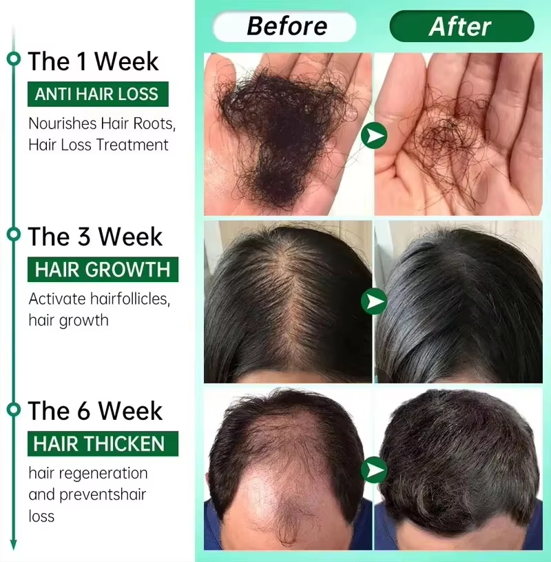 سيروم نمو الشعر، كبسولات أساسي - مراجعة Hair Care Capsule وسعره