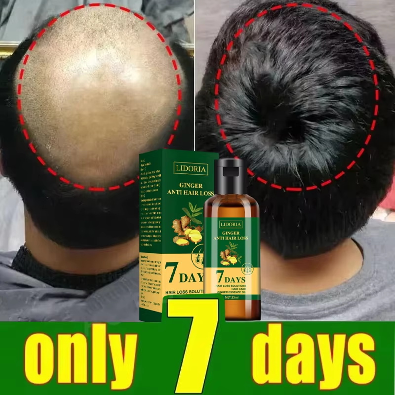 سيروم نمو الشعر، كبسولات أساسي - مراجعة Hair Care Capsule وسعره