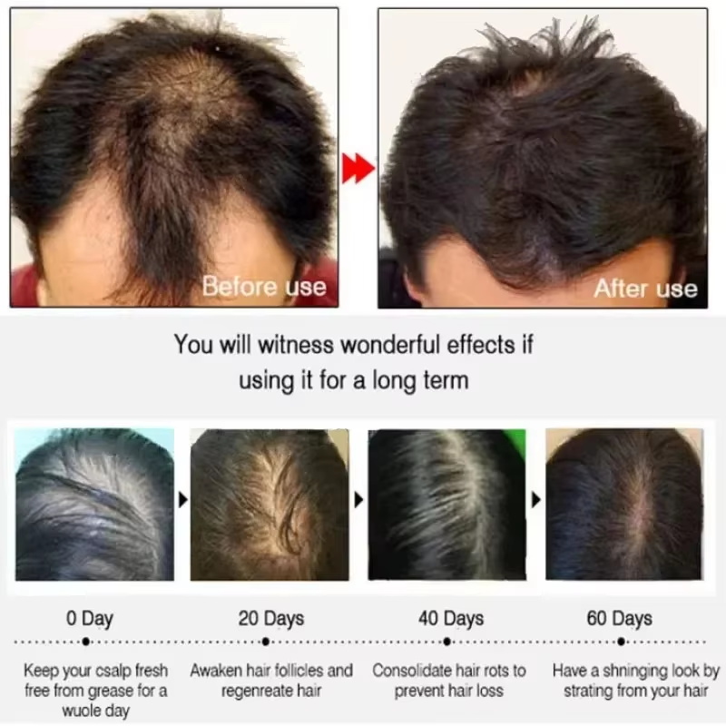 سيروم نمو الشعر، كبسولات أساسي - مراجعة Hair Care Capsule وسعره