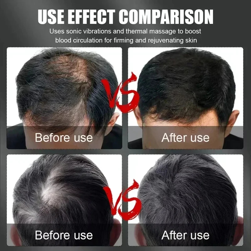 قبعة علاج الشعر بالضوء الأحمر  - مراجعة Hair Care For Hair Growth وسعره